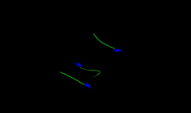 Mikroskopický snímek myších spermií, na kterých je zeleně zobrazeno „sirovodíkové brnění“‎. Foto: archiv Jana Nevorala.
